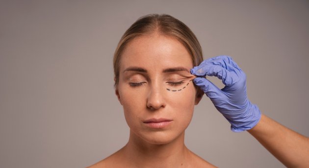 Blefaroplastia 4 parpados en CDMX y Torreón