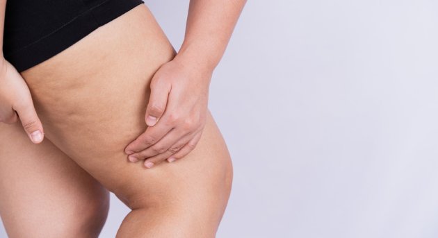 Cirugía de Cruróplastia en CDMX y Torreón